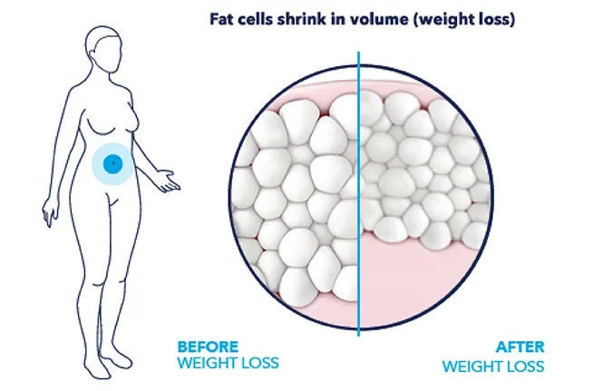 fat-reduction-before-and-after-results