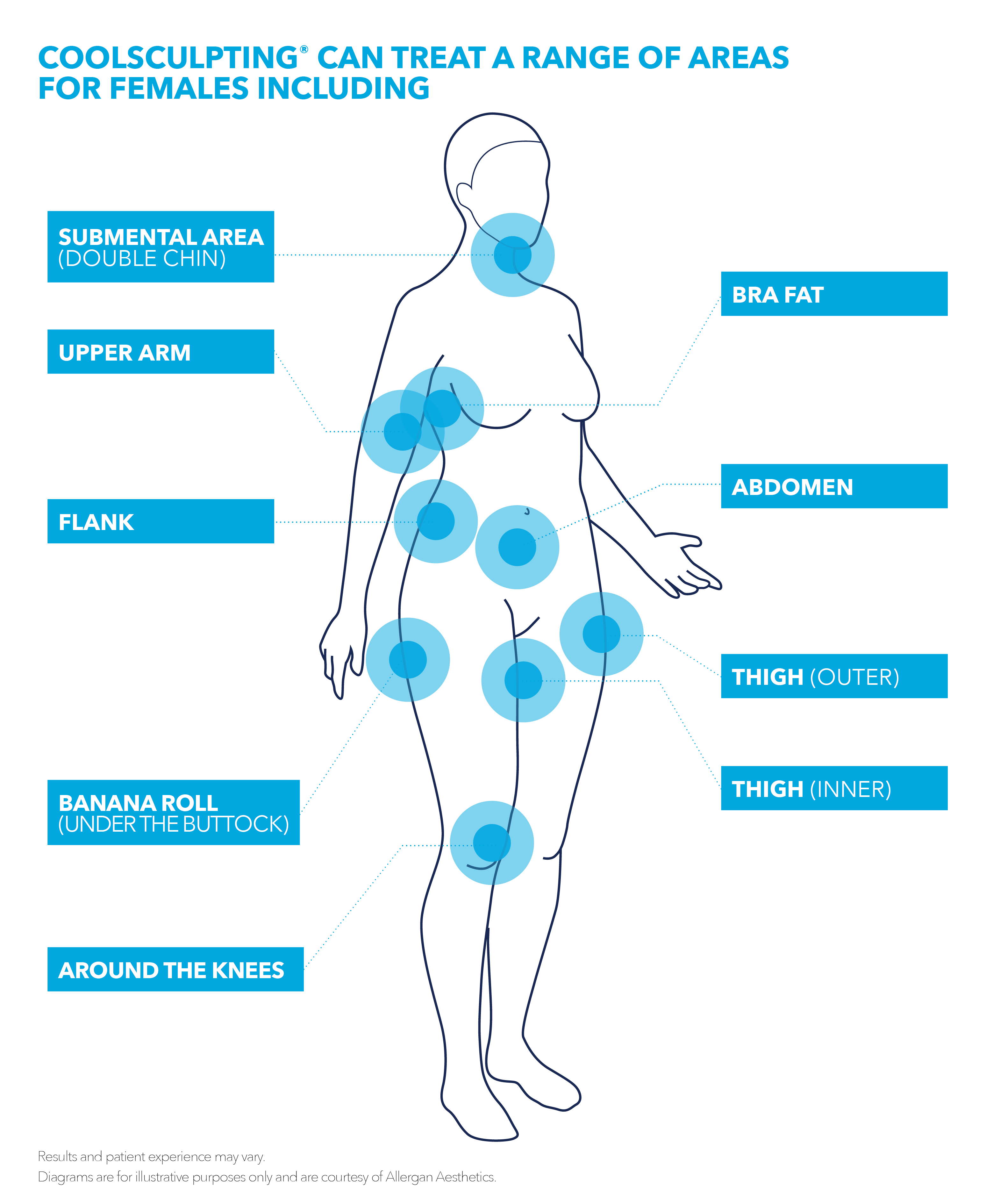 CoolSculpting® can treat a range of areas of females