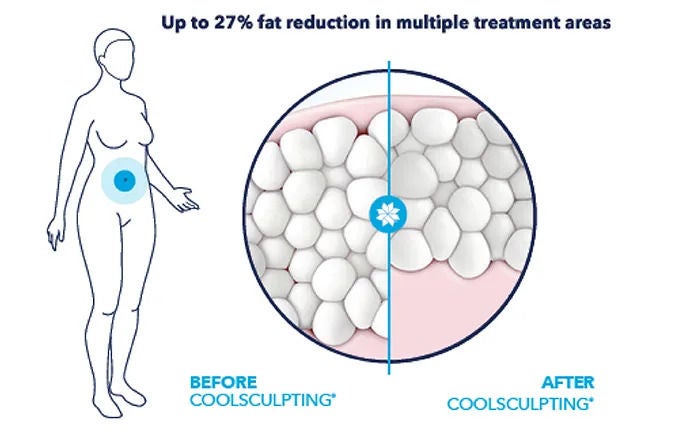 fat-reduction-before-and-after-results